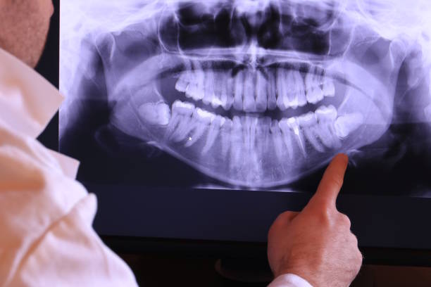 Best Urgent Care for Lost Fillings or Crowns in Colleyville, TX