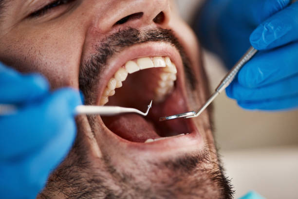 Best Emergency Dental Care for Broken or Chipped Teeth in Colleyville, TX