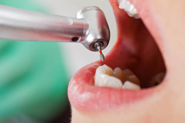 Best Emergency TMJ Treatment in Colleyville, TX